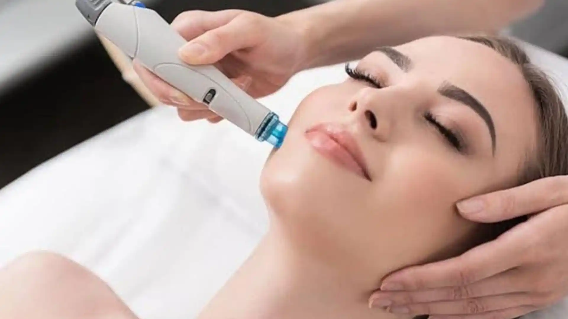 Dermabrasion by Whimsy Aesthetic Clinic