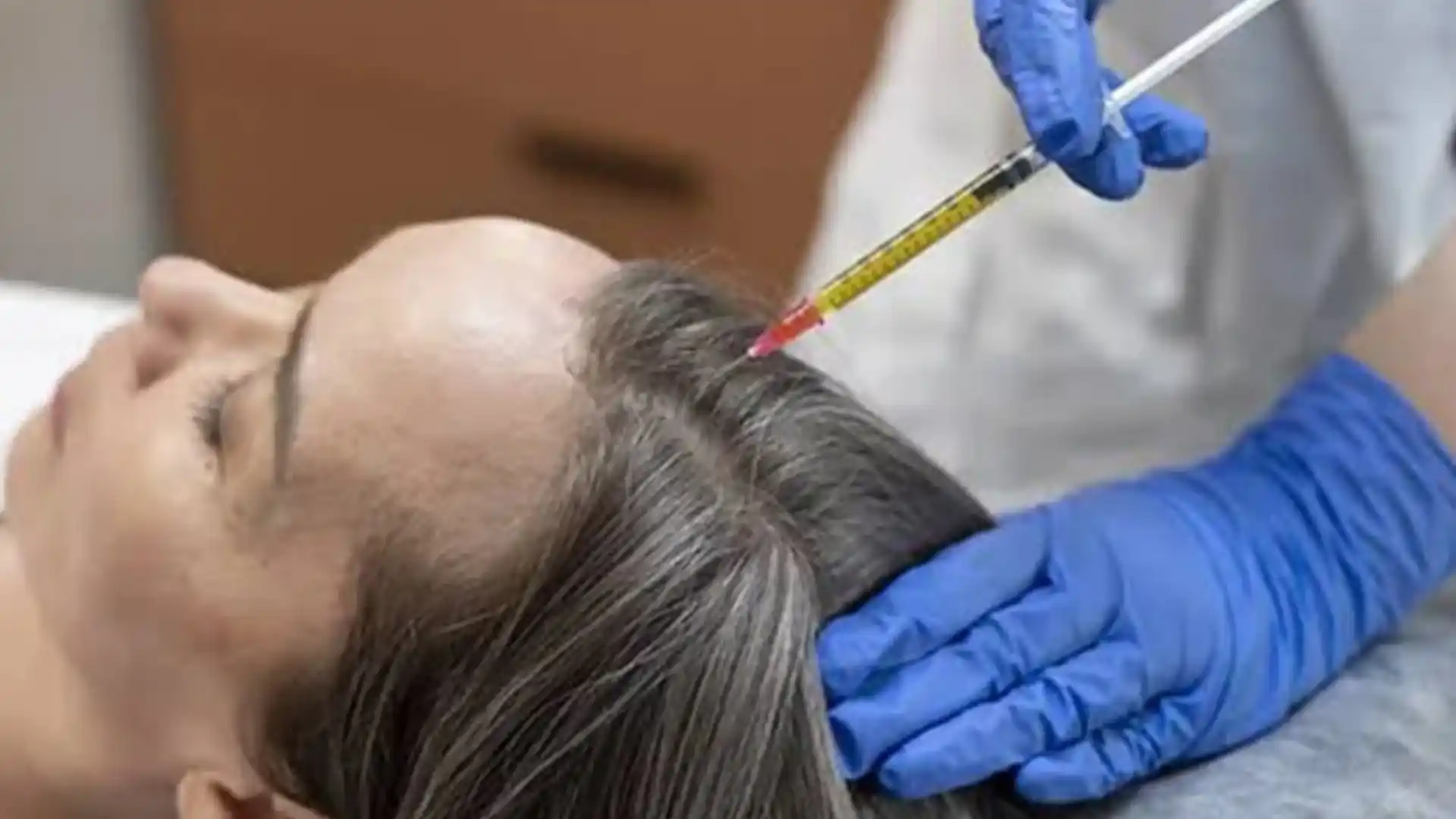 PRP by Whimsy Aesthetic Clinic