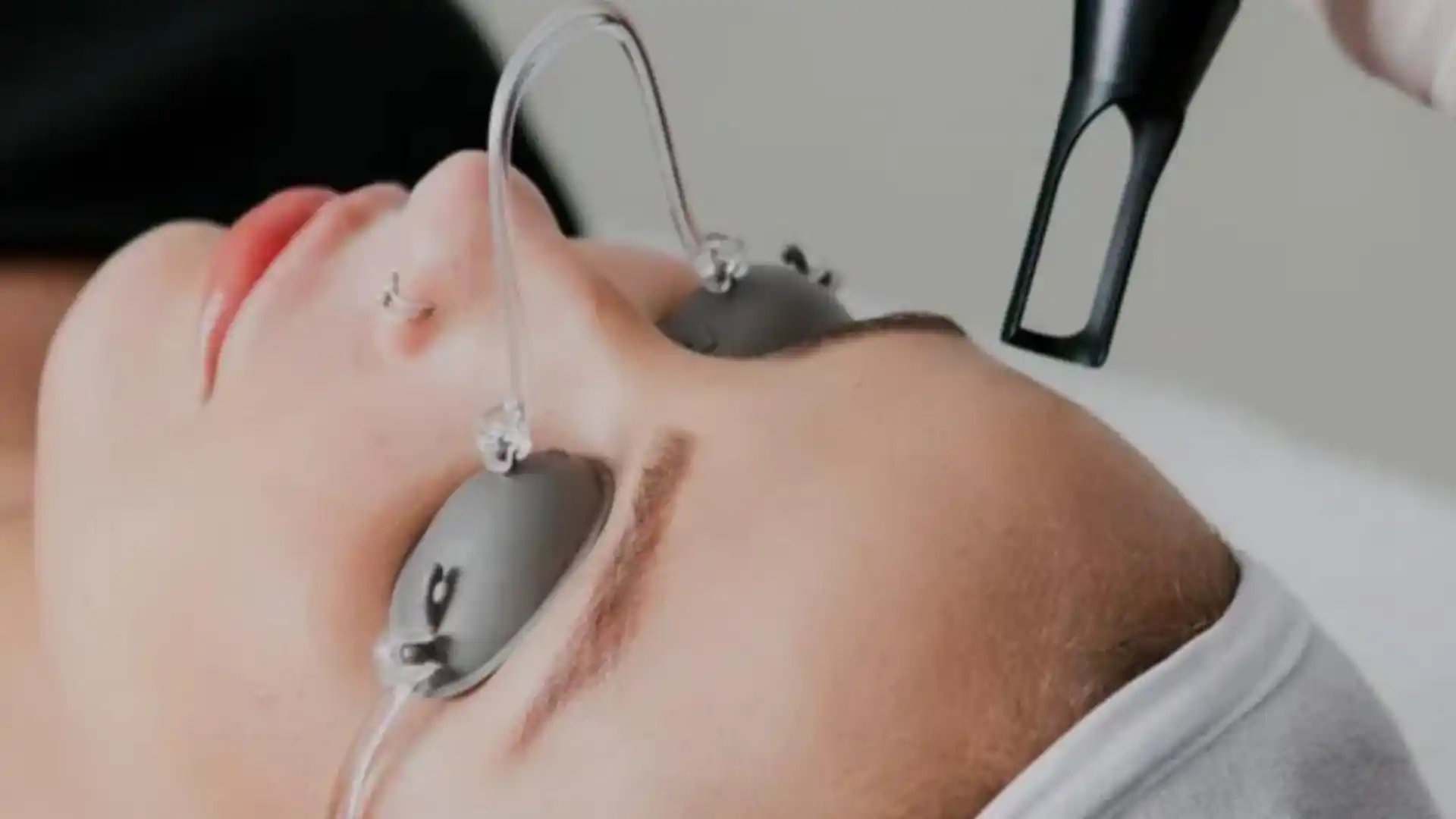 Q-switch laser by Whimsy Aesthetic Clinic